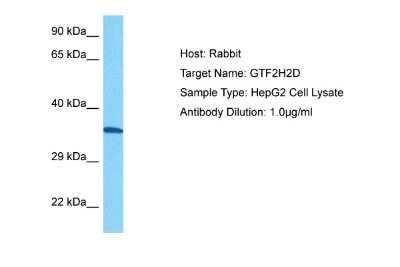 Western Blot: GTF2H2 Antibody [NBP2-87535]