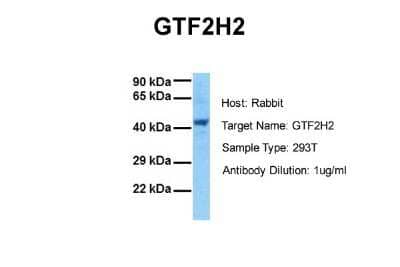 Western Blot: GTF2H2 Antibody [NBP2-87537]