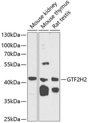 Western Blot: GTF2H2 AntibodyBSA Free [NBP3-03903]