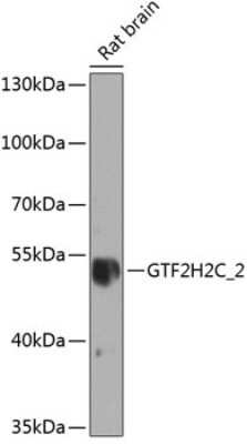 Western Blot: GTF2H2D AntibodyBSA Free [NBP3-05592]