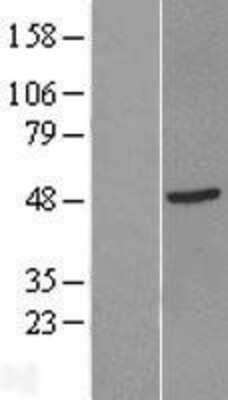 Western Blot: GTF2H2D Overexpression Lysate [NBL1-12630]