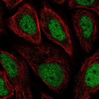 Immunocytochemistry/ Immunofluorescence: GTF2H3 Antibody [NBP2-30371]