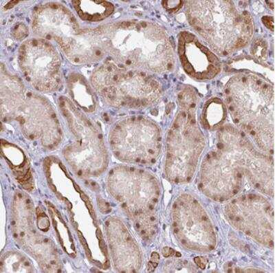 Immunohistochemistry: GTF2H3 Antibody [NBP2-30371]