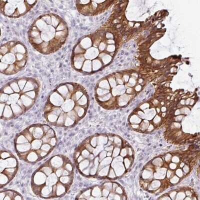 Immunohistochemistry-Paraffin: GTF2H3 Antibody [NBP2-30407]