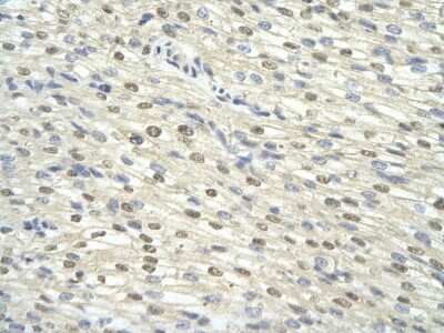 Immunohistochemistry-Paraffin: GTF2H3 Antibody [NBP2-87539]