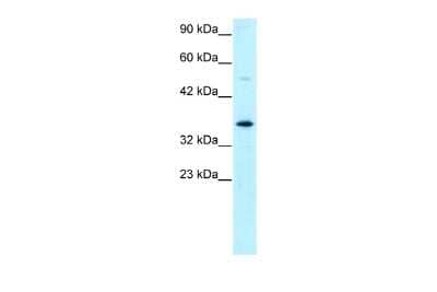 Western Blot: GTF2H3 Antibody [NBP2-87539]