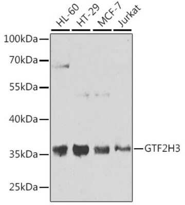 Western Blot: GTF2H3 AntibodyBSA Free [NBP3-04662]