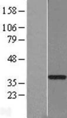 Western Blot: GTF2H3 Overexpression Lysate [NBL1-11390]