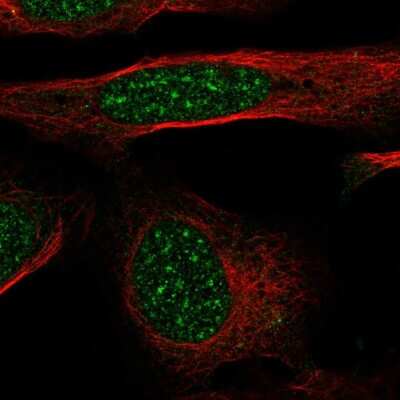 Immunocytochemistry/ Immunofluorescence: GTF2H4 Antibody [NBP2-57537]