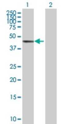 Western Blot: GTF2H4 Antibody [H00002968-B01P]