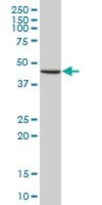 Western Blot: GTF2H4 Antibody [H00002968-B02P]