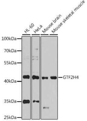 Western Blot: GTF2H4 AntibodyBSA Free [NBP3-04644]