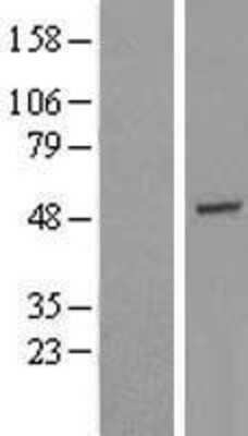 Western Blot: GTF2H4 Overexpression Lysate [NBL1-11391]