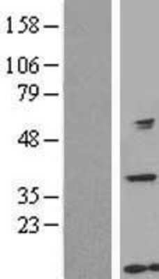 Western Blot: GTF2H5 Overexpression Lysate [NBL1-11392]