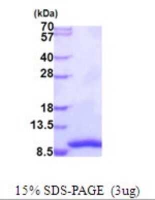 SDS-PAGE: Recombinant Human GTF2H5 His Protein [NBP2-51891]