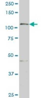 Western Blot: GTF2IRD1 Antibody (1D2) [H00009569-M01]