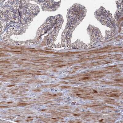 Immunohistochemistry-Paraffin: GTF2IRD1 Antibody [NBP1-91973]