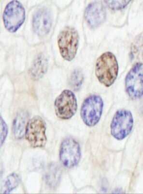 Immunohistochemistry-Paraffin: GTF2IRD1 Antibody [NB100-61055]