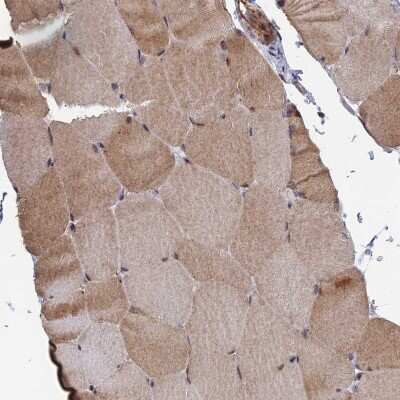 Immunohistochemistry-Paraffin: GTF2IRD1 Antibody [NBP1-91973]