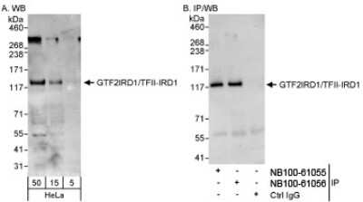 Western Blot: GTF2IRD1 Antibody [NB100-61056]