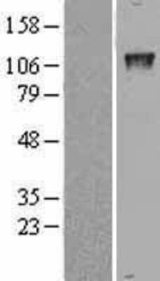 Western Blot: GTF2IRD1 Overexpression Lysate [NBL1-11393]