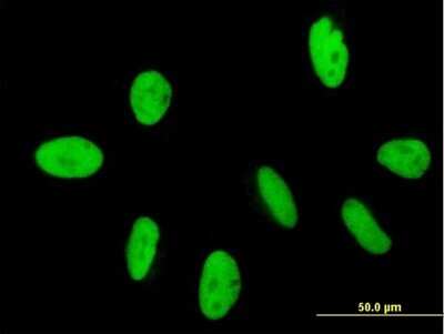 Immunocytochemistry/ Immunofluorescence: GTF2IRD2 Antibody [H00084163-B01P]