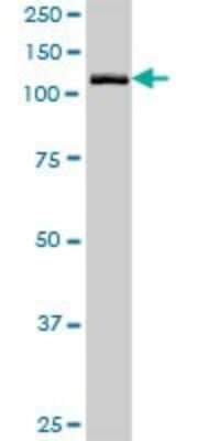 Western Blot: GTF2IRD2 Antibody [H00084163-B01P]