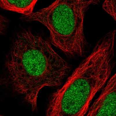 Immunocytochemistry/ Immunofluorescence: GTF2IRD2B Antibody [NBP2-55294]