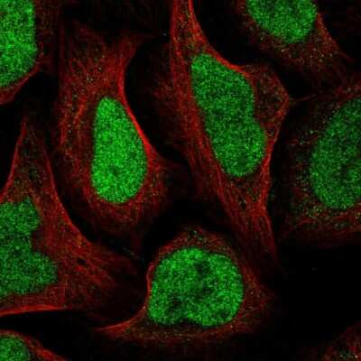 Immunocytochemistry/ Immunofluorescence: GTF2IRD2B Antibody [NBP2-55548]