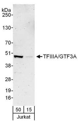 Western Blot: GTF3A Antibody [NBP2-04017]