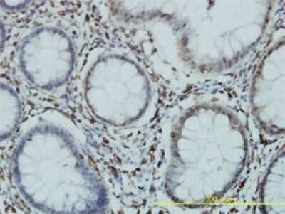 Immunohistochemistry-Paraffin: GTF3C2 Antibody (1C6-2B8) [H00002976-M01]