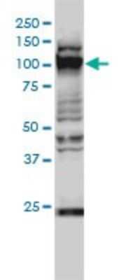 Western Blot: GTF3C2 Antibody (1C6-2B8) [H00002976-M01]