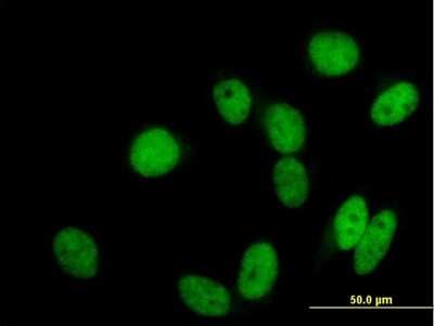 Immunocytochemistry/ Immunofluorescence: GTF3C2 Antibody [H00002976-B01P]