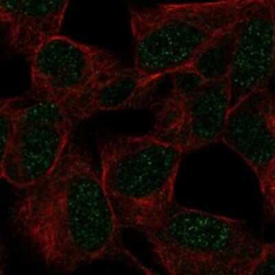 Immunocytochemistry/ Immunofluorescence: GTF3C2 Antibody [NBP3-17860]