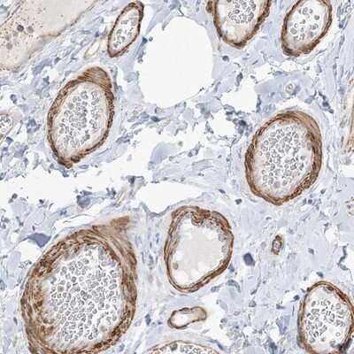 Immunohistochemistry-Paraffin: GTF3C2 Antibody [NBP1-83062]