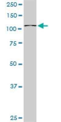 Western Blot: GTF3C2 Antibody [H00002976-B01P]