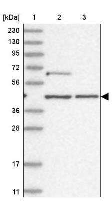 Western Blot: GTF3C2 Antibody [NBP1-83062]