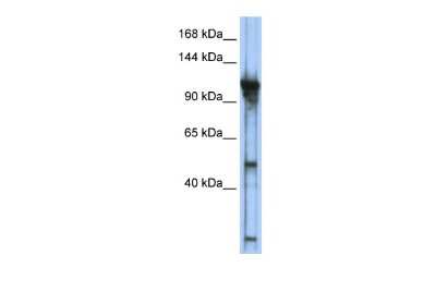 Western Blot: GTF3C2 Antibody [NBP3-10918]