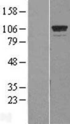 Western Blot: GTF3C2 Overexpression Lysate [NBL1-11394]