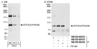 Western Blot: GTF3C4 Antibody [NB100-60432]