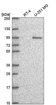 Western Blot: GTF3C4 Antibody [NBP2-57486]