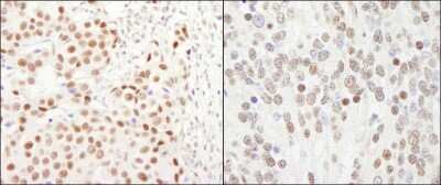 Immunohistochemistry: GTF3C5 Antibody [NB100-60435]