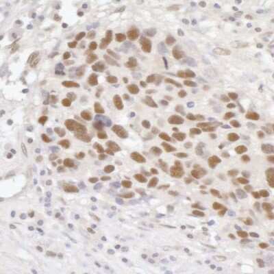 Immunohistochemistry: GTF3C5 Antibody [NB100-60435]