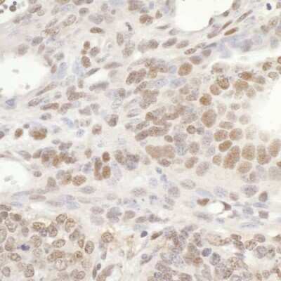 Immunohistochemistry: GTF3C5 Antibody [NB100-60435]
