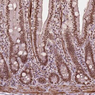 Immunohistochemistry: GTF3C5 Antibody [NBP2-49504]