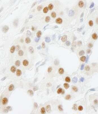 Immunohistochemistry-Paraffin: GTF3C5 Antibody [NB100-60435]