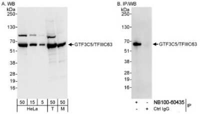 Western Blot: GTF3C5 Antibody [NB100-60435]