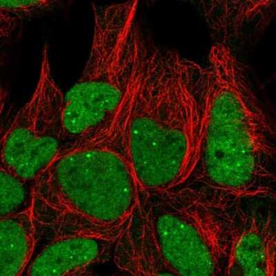 Immunocytochemistry/ Immunofluorescence: GTF3C6 Antibody [NBP2-31851]