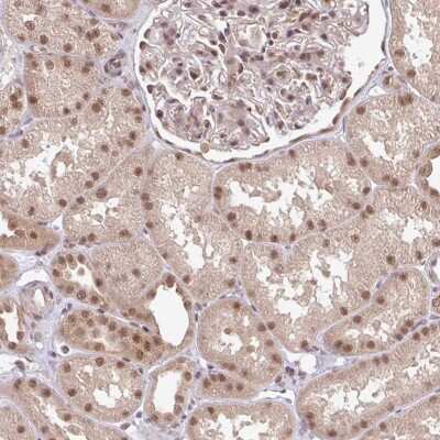 Immunohistochemistry: GTF3C6 Antibody [NBP2-31628]