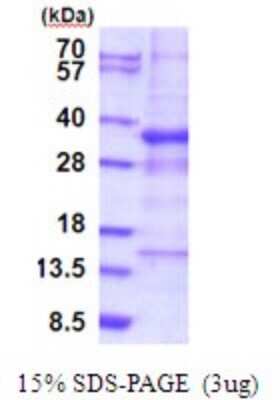 SDS-PAGE: Recombinant Human GTF3C6 His Protein [NBP2-51894]